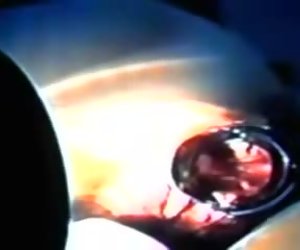 (01)            (            )(         )(         )(                        )Zhangjiajing Nurses Taiwan Taiwanese Nurses